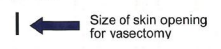 Line the size of a sesame seed with an arrow pointing to it